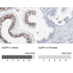anti-ULBP-1, Polyclonal, Novus Biologicals 0.1mL; Unlabeled:Antibodies,